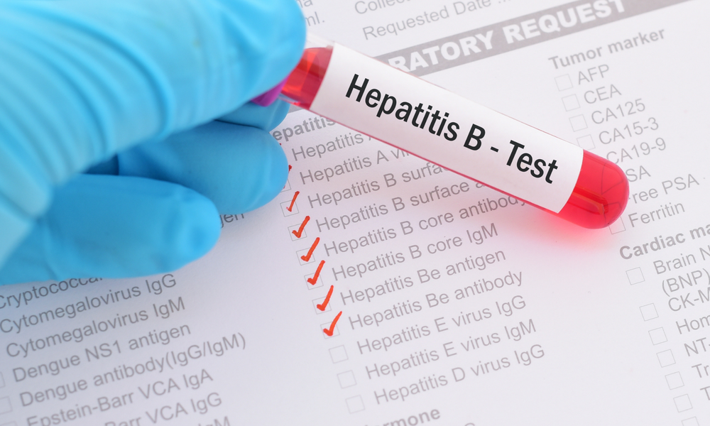Why 90% of People with Hepatitis Don’t Know About It. Here Is What You Need to Know