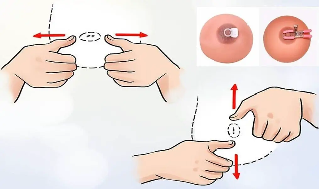 This method has been in use since 1953, made for enlarging inverted and flat nipples.